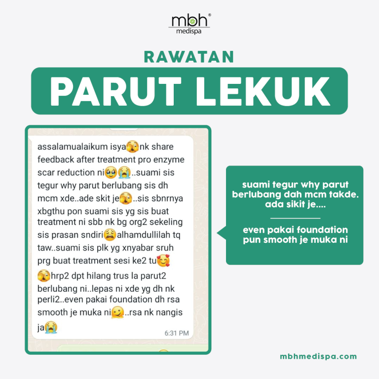 PARUT LEKUK-15 (2)